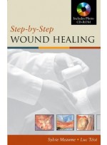 Step By Step Wound Healing with CD