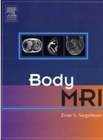 Body MRI