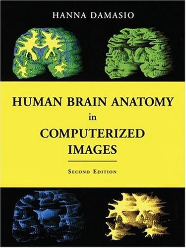 Human Brain Anatomy in Computerized Image,2/e