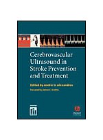 Cerebrovascular Ultrasound and Stroke Management