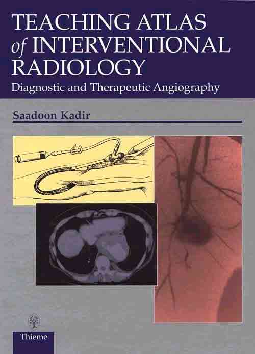 Teaching Atlas of Interventional Radiology: Diagnostic and Therapeutic Angiography