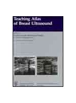 Teaching Atlas of Breast Ultrasound