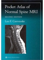Pocket Atlas of Normal Spinal Mri