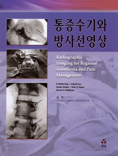 통증수기와 방사선영상 (Radiographic Imaging Regional Anesthesia and Pain Management )