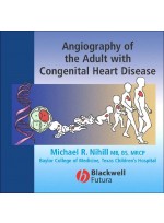 Angiography of the Adult with Congenital Heart Disease