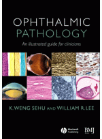 Ophthalmic Pathology An Illustrated Guide for Clinicians