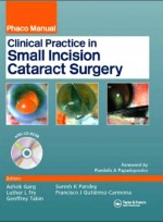 Clinical Practice In Small Incision Cataract Surgery