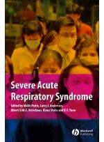 Severe Acute Respiratory Syndrome : A Clinical Guide