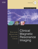 Clinical Magnetic Resonance Imaging(3 Vol Set),3/e