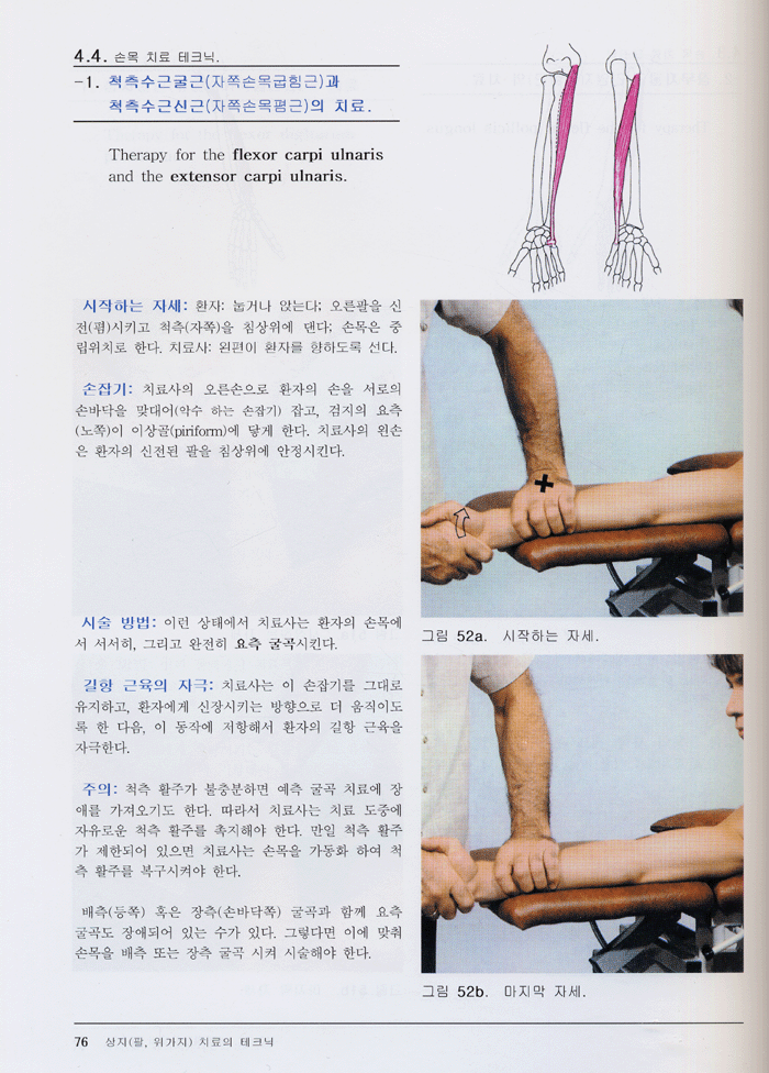 근육 신장의 맨손요법 -실전의 길잡이 제1권 팔 다리 편