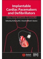 Implantable Cardiac Pacemakers and Defibrillators: All You Wanted to Know