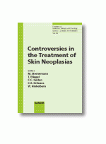 Controversies in the Treatment of Skin Neoplasias
