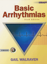 Basic Arrhythmias, 6/e