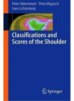 Classifications and Scores of the Shoulder