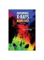 Abdominal X-Rays Made Easy,2/e