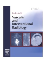 Vascular and Interventional Radiology, 2th Edition