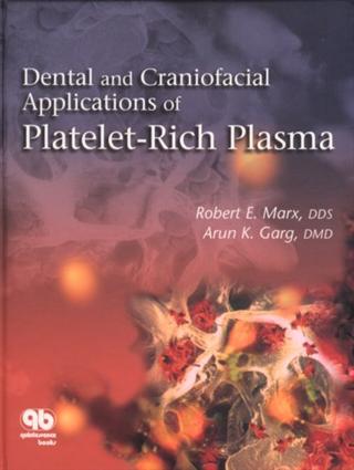 Dental and Craniofacial Applications of Platelet-Rich Plasma