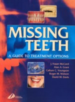 Missing Teeth: A Guide to Treatment Options