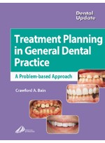 Treatment Planning in General Dental Practice