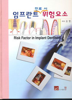 임프란트진료시위험요소 (Risk Factor in Implant Dentistry)