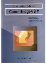 One point advice Crown Bridge의 임상