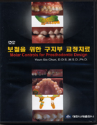(DVD)보철을 위한 구치부 교정치료(Molar Controls for Prosthodontic Design)