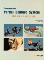 Contemporary Partial Denture System: 최신국소의치임상 및 기공