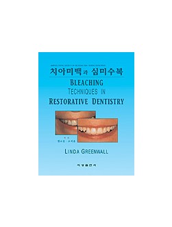 치아미백과 심미수복 - Bleaching Techniques in Restorative Dentistry -