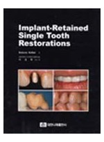 Implant-Retained Single Tooth Restorations