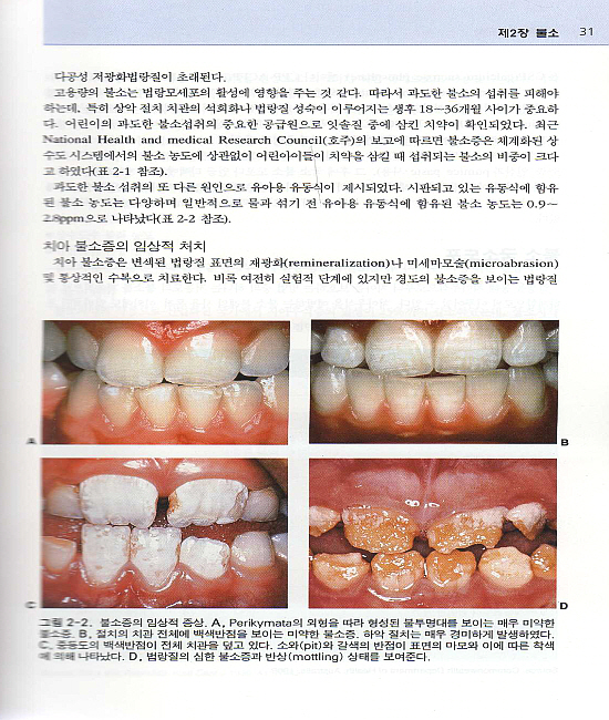 소아치과 핸드북(제2판); Handbook of Pediatric Dentistry