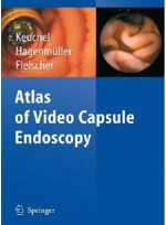 Atlas of Video Capsule Endoscopy