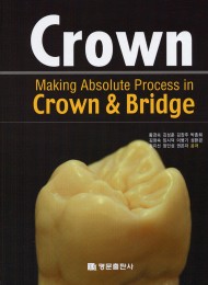 Crown - Making Absolute Process in Crown & Bridge
