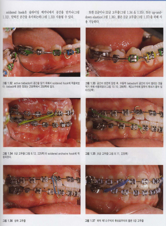 체계적인 임상교정치료 -Systemized Orthodontic Treatment Mechanics-
