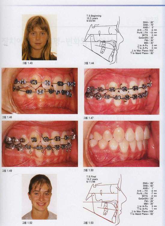 체계적인 임상교정치료 -Systemized Orthodontic Treatment Mechanics-
