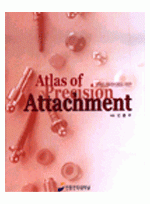 Atlas of Precision Attachment (최신 심미보철을 위한)