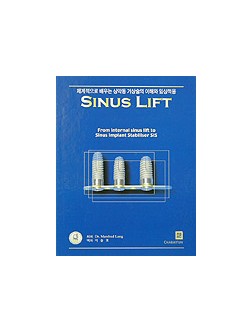 SINUS LIFT - 체계적으로 배우는 상악동 거상술의 이해와 임상적용 -