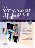 Foot and Ankle in Rheumatoid Arthritis,The - A Comprehensive Guide