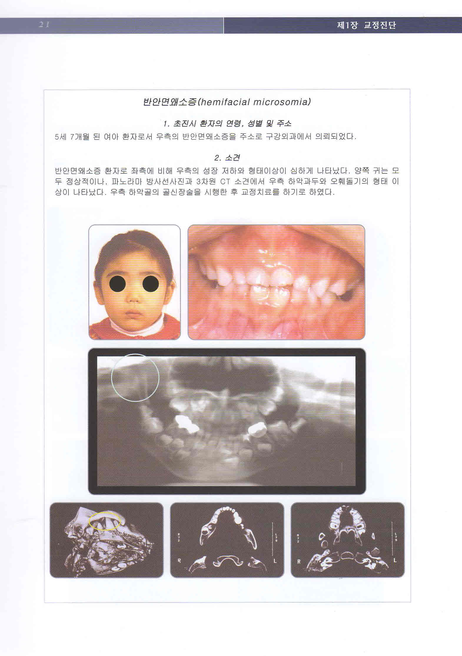 최신 치과교정 진단학 - Current Orthodontic Diagnosis -