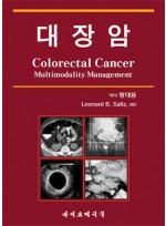 대장암:Colorectal Cancer