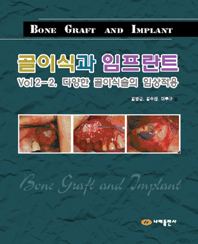 골이식과임프란트 Vol 2-2.다양한 골이식술의 임상적용