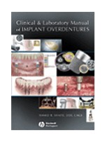 Clinical & Laboratory Manual of Implant Overdentures