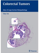 Colorectal Tumors:Atlas of Large Section Histopathology