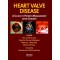 Heart Valve Disease:A Guide to Patient Management After Surgery