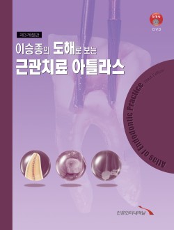 이승종의 도해로 보는 근관치료 아틀라스 (제3개정판)