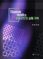 Titanium-mesh와 임플란트의 실패 극복