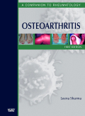 Osteoarthritis - A Companion to Rheumatology