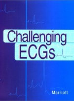 Challenging ECGs