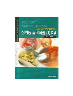 기초부터 문제해결까지 상악동 골이식술 Q & A