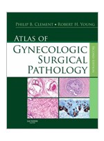 Atlas of Gynecologic Surgical Pathology,2/e