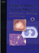 Clinical Atlas of Airway Disease - Bronchoscopy, Radiology and Pathology